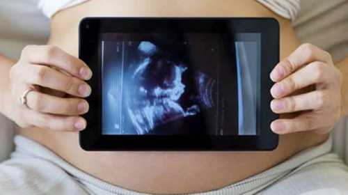 贵州代怀孕产子网 贵州省新冠疫情最新消息 ‘唐筛报告看男女准么？’