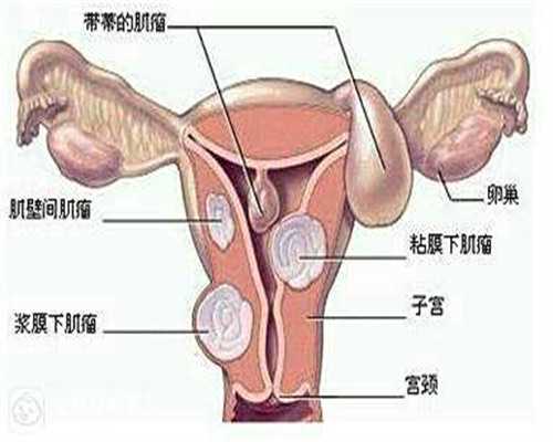 什么是吉尔吉斯斯坦试管婴儿技术,代生费用明细