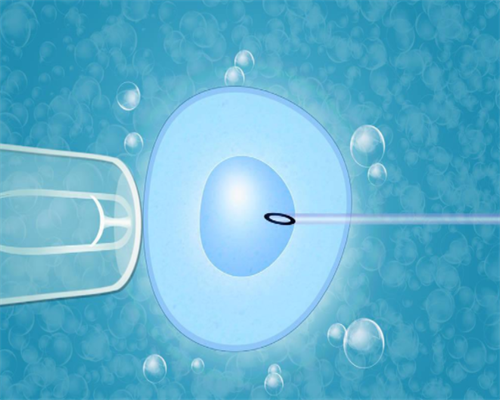 怀孕10周胎停有什么症状或征兆吗（详解胎停的症状和预防措施）