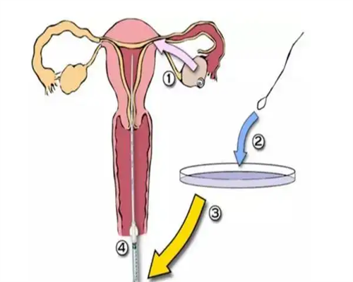 贵阳代孕准备|北京供卵试管医院名单列表，不用排队可走绿色通道？