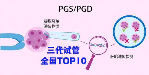 贵阳代孕正规靠谱|河源三代试管遗传疾病筛查