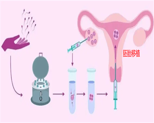 贵阳代孕公司在哪里,令人意外!泰国成功治愈新型肺炎!泰国试管婴儿欢迎率再创