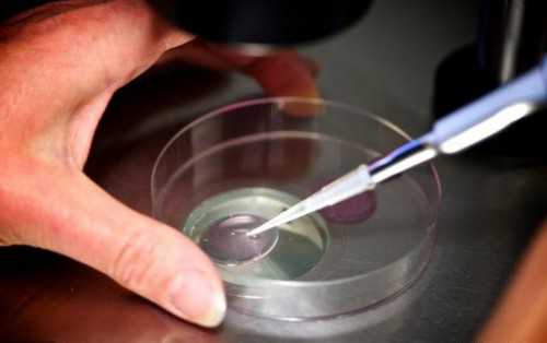 贵阳私人代孕医院,贵阳做试管过程中需要注意哪些事项呢?-深圳借卵试管婴儿医