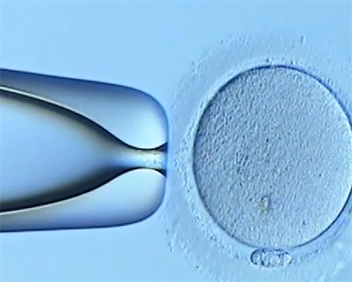 高龄备孕如何缓解压力?