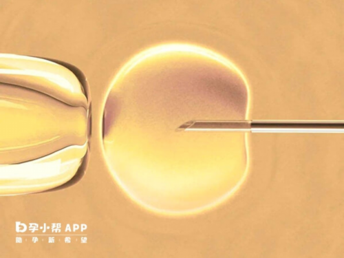 那里能代生孩子,北京三代试管包男孩靠谱吗-B超时医生说挺宽的代表男孩还是女