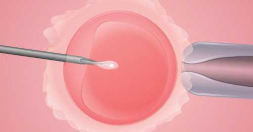 卵巢囊肿为什么不能拖？恶变风险很多是拖出来的！,供卵产子费用