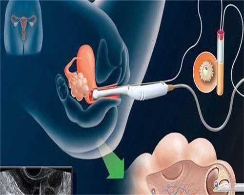 贵阳不孕不育治疗医院：贵阳治疗不育最权威的国家医院