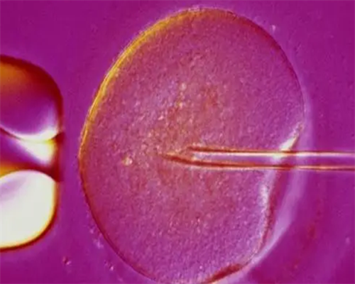 精子和卵子让别人代生,试管长方案适合哪些人群，流程中要注意什么？_香港一